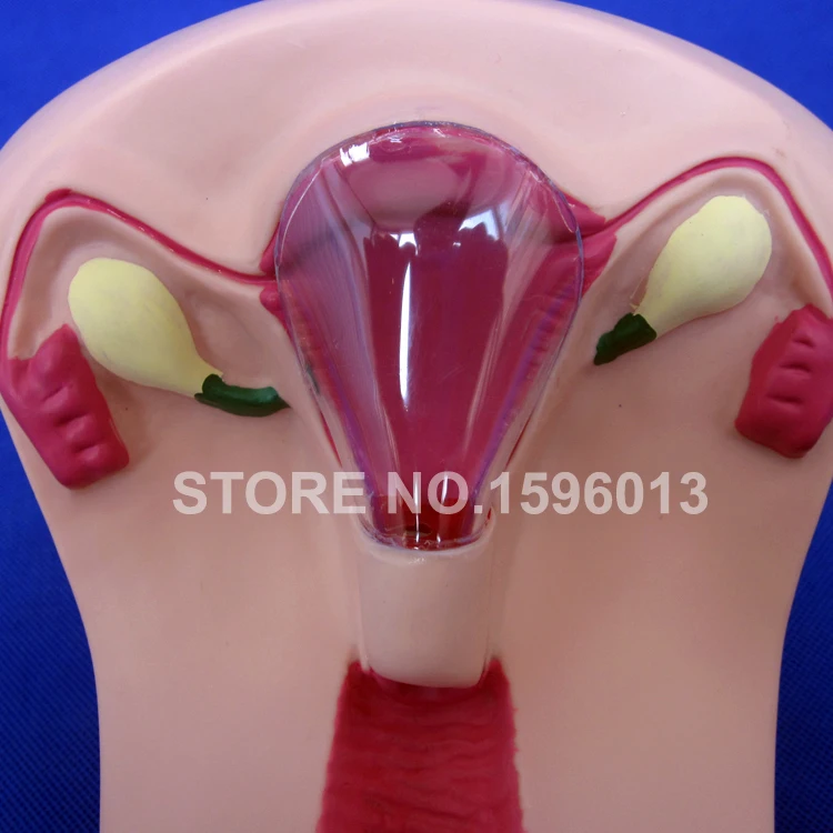 B3 IUD simulator (5)