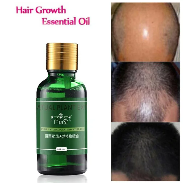Hair Care Hair Growth Essential Oils Essence Original Authentic 100% Hair Loss Liquid Health Care Beauty Dense Hair Growth Serum 1