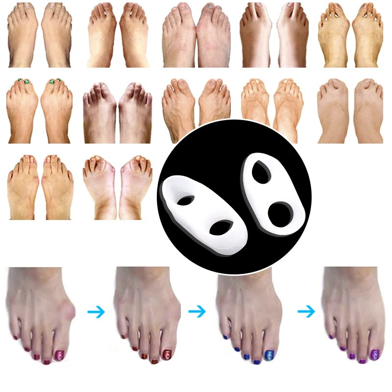 1Pair=2pcs Silicone Little Toe Finger Straightener Hallux Valgus Bunion Corrector Foot Health Care Product smrp