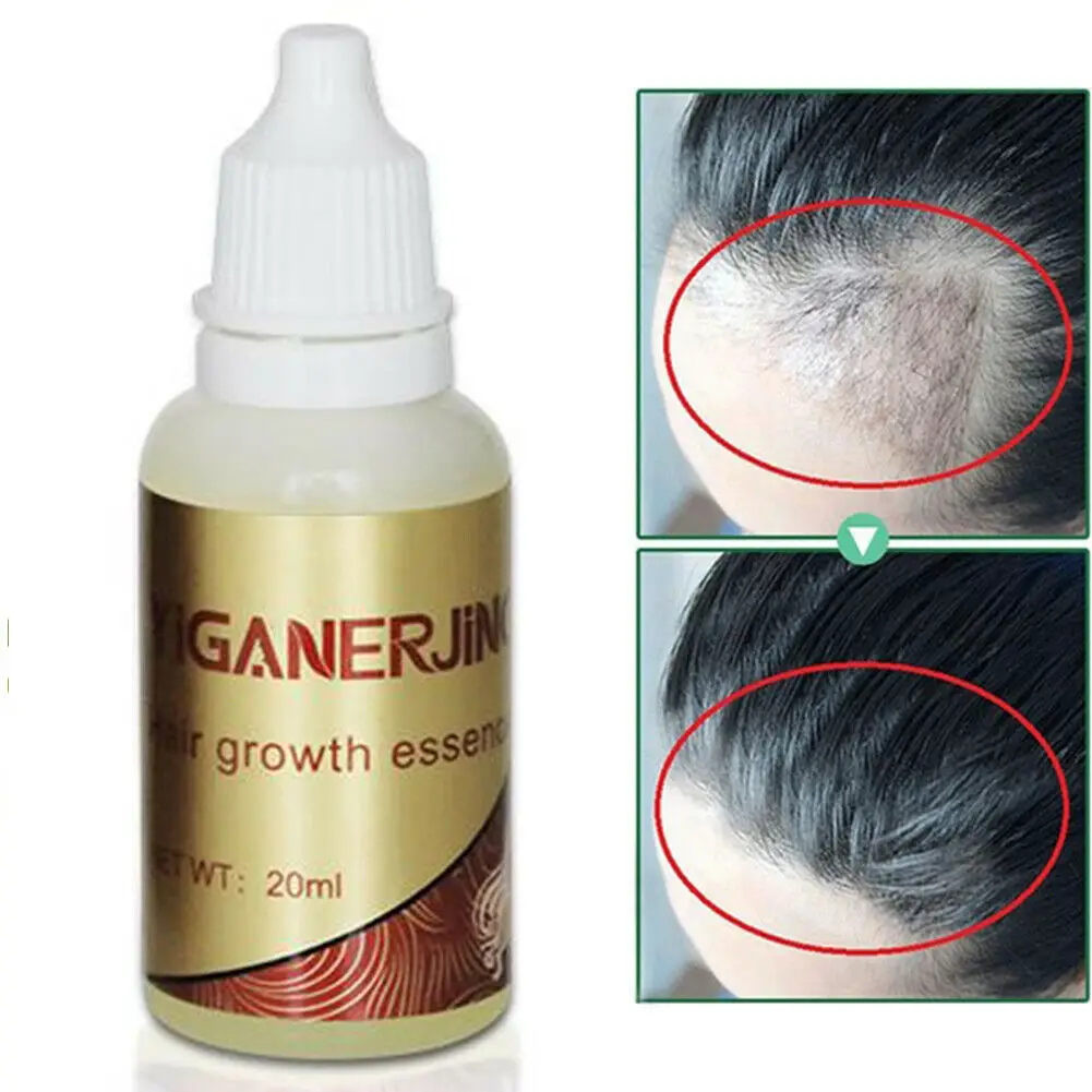 

Hair Growth Serum Essence 20ml Essence Liquid Natural Pure Original Essential Oil Fast Grow Restoration Treatment Hair CareTSLM1