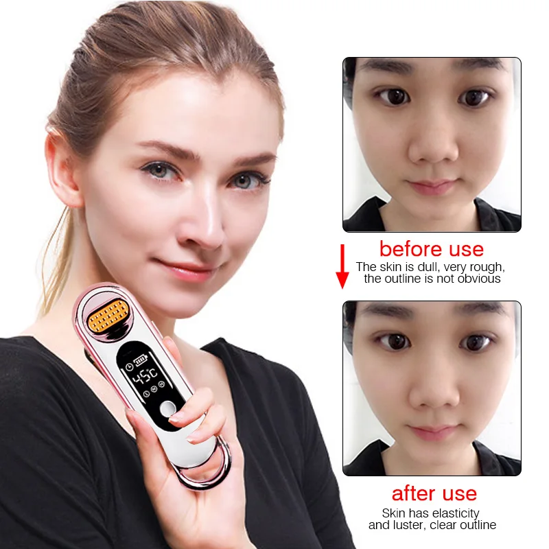 

Dot Matrix RF Therapy Lifting Skin Wrinkle Removal Beauty Machine Radio Frequency Rejuvenation Body Skin Device Health Care