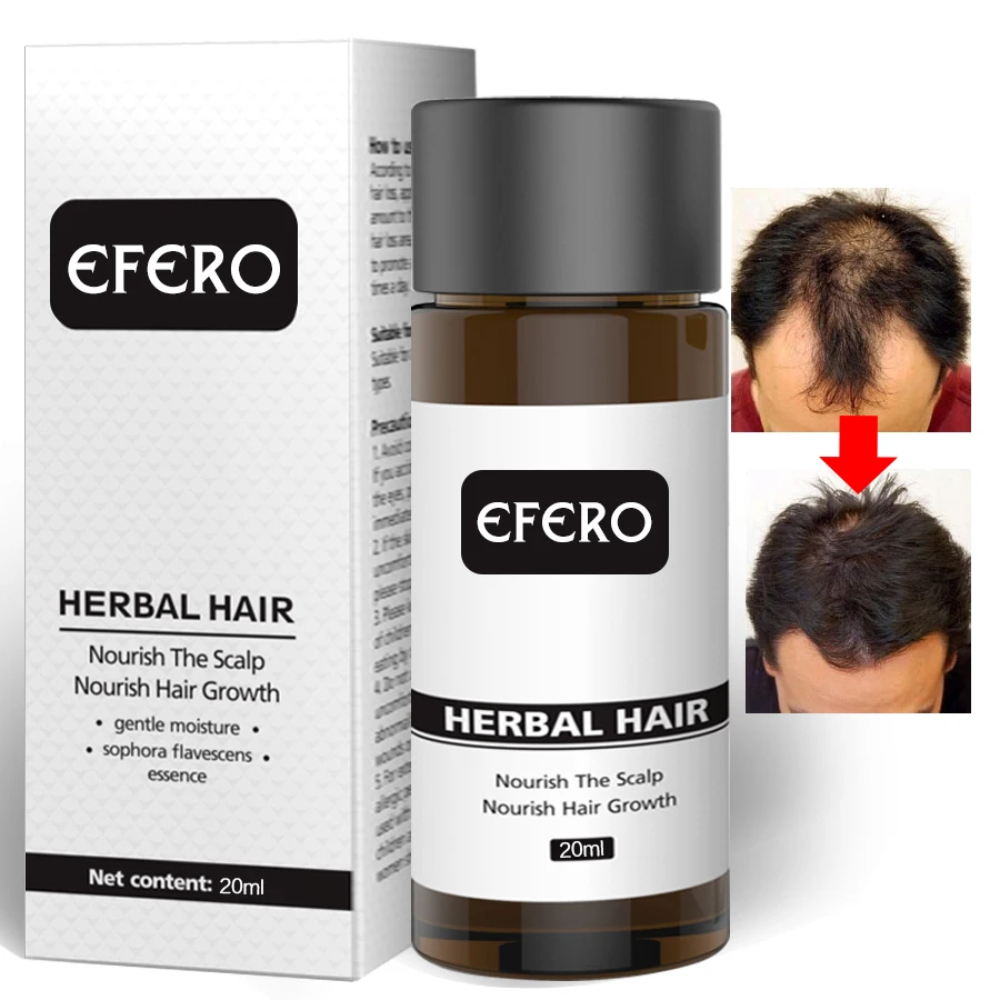 EFERO Hair Care Hair Growth Essence Essential Oils Prevent Hair Loss Products Growth Serum Damaged Hairs Treatment Repair 20ml EFERO Hair Care Hair Growth Essence Essential Oils Prevent Hair Loss Products Growth Serum Damaged Hairs Treatment Repair 20ml