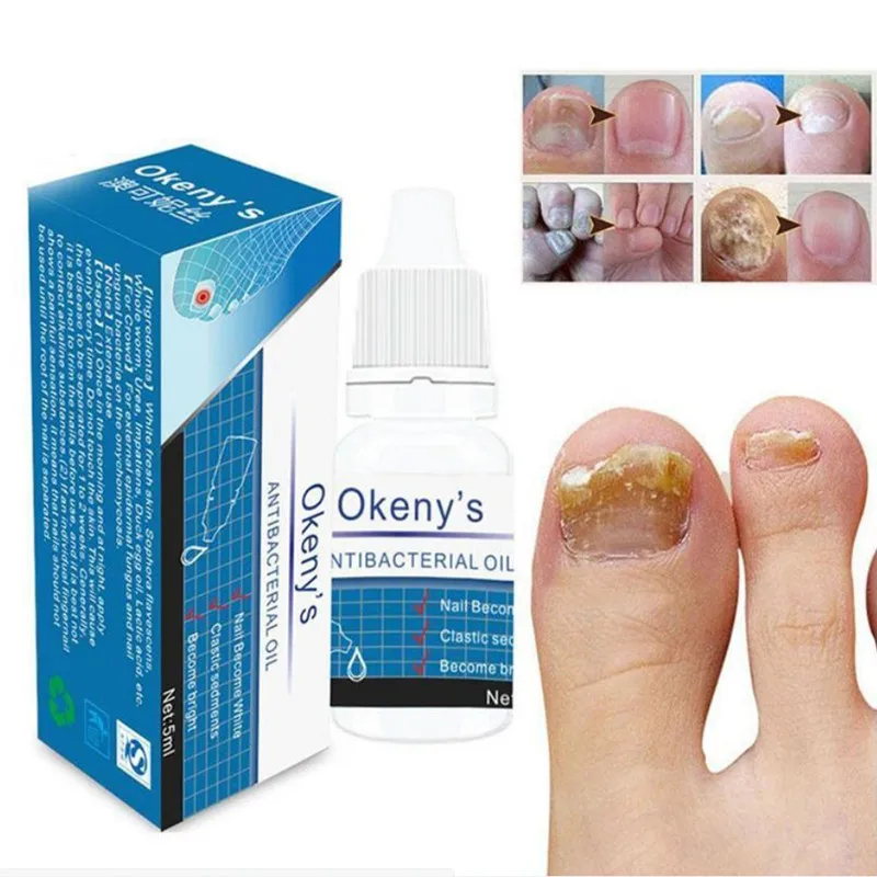 

Nail Foot Fungus Remove Gel Remedy For Nail Fungus Treatment Feet Care Essence Whitening Toe From Antifungal Onychomycosis Cream