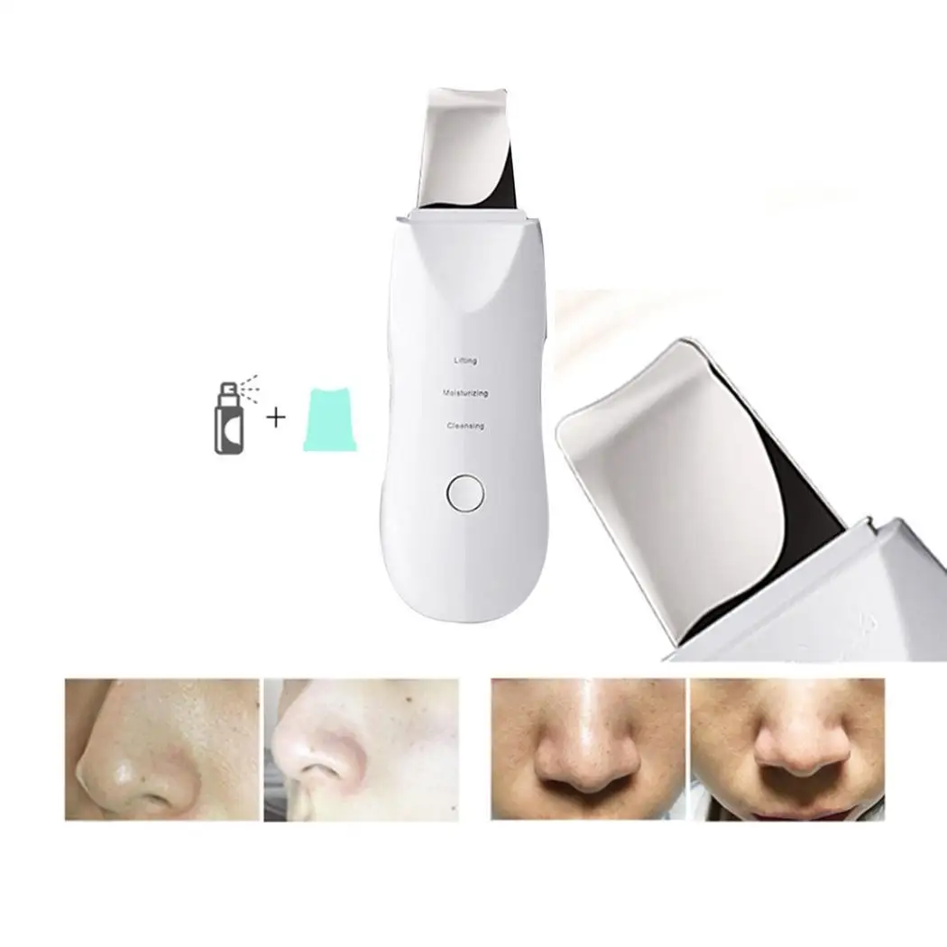 

Ultrasonic Skin Scrubber USB Charge Ultrasound Peeling Face Cleansing Blackhead Pore Acne Removal Cleaner Beauty Instrument