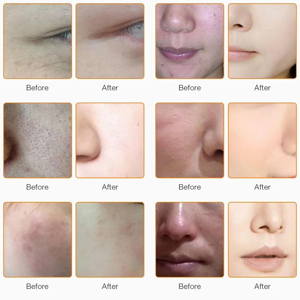 CLC-102310-EU US (8)