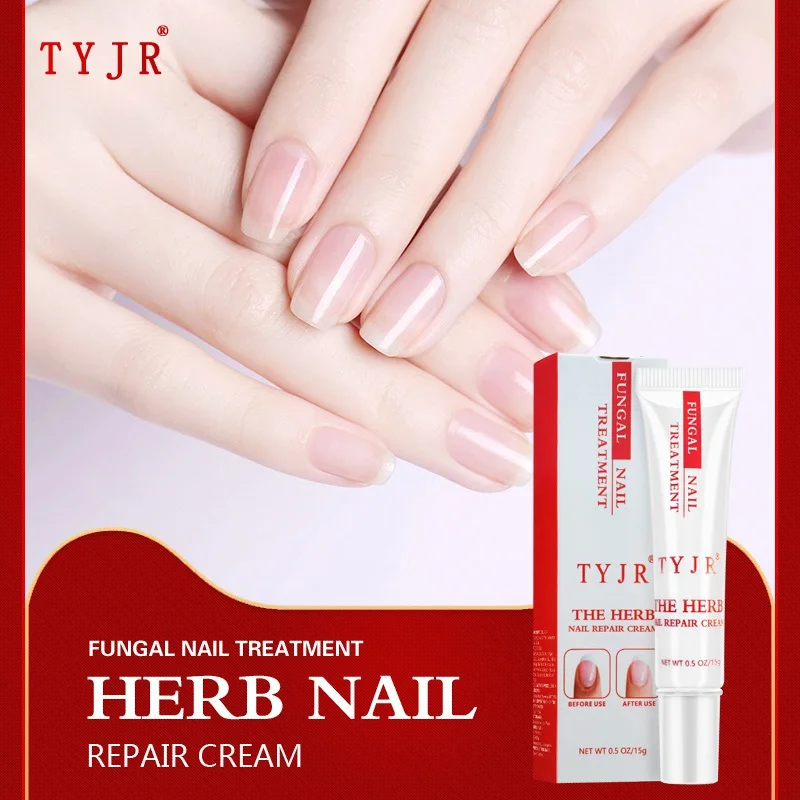 

Kills 99.9% Bacteria Nail Care Treatment Nail Fungus Oil Onychomycosis Paronychia Anti Fungal Nail Infection 15g Repair Nails