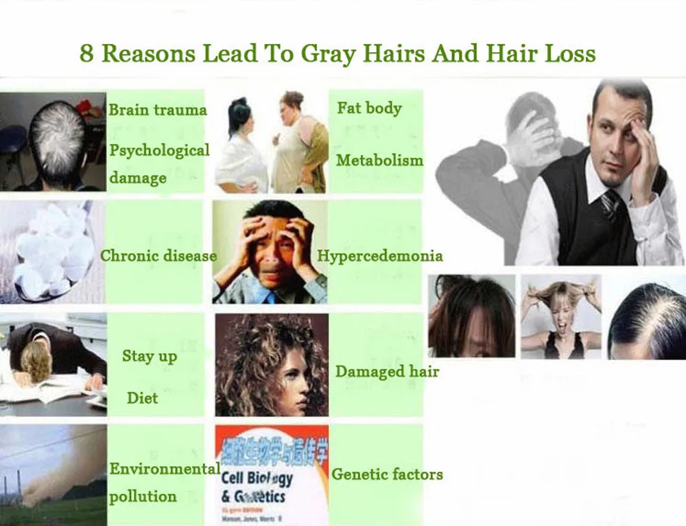 Essenciais de Crescimento do Cabelo Produtos para Perda de Cabelo Cuidados de Saúde Cuidados com os Cabelos Óleos Essência Anti Beleza Mais Rápida Crescer Densos Soro Líquido 6 Óleos Essenciais de Crescimento do cabelo Essência