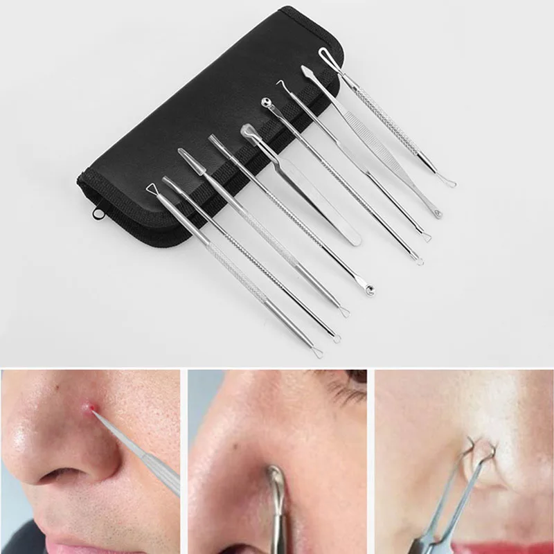 Blackhead Remover Tool Kit Stainless Steel Acne Extractor Removal Face