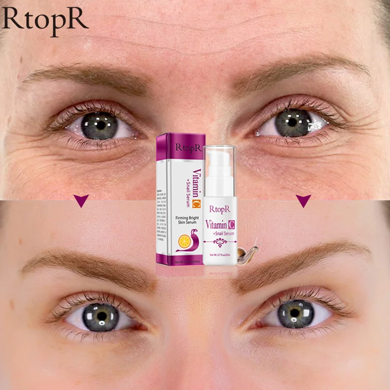 

VitaminC Snail Serum Rejuvenation Anti Wrinkle Firming Bright Skin Serum For Face Ance Treatment Snail VC Collagen Repair Serum