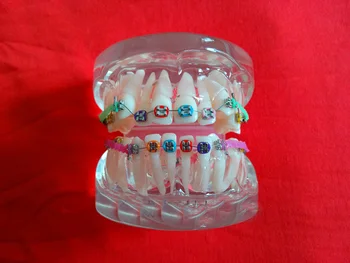 

white transparent dental tooth Orthodontists model Malocclusion orthodontic models Teaching model Dental materials