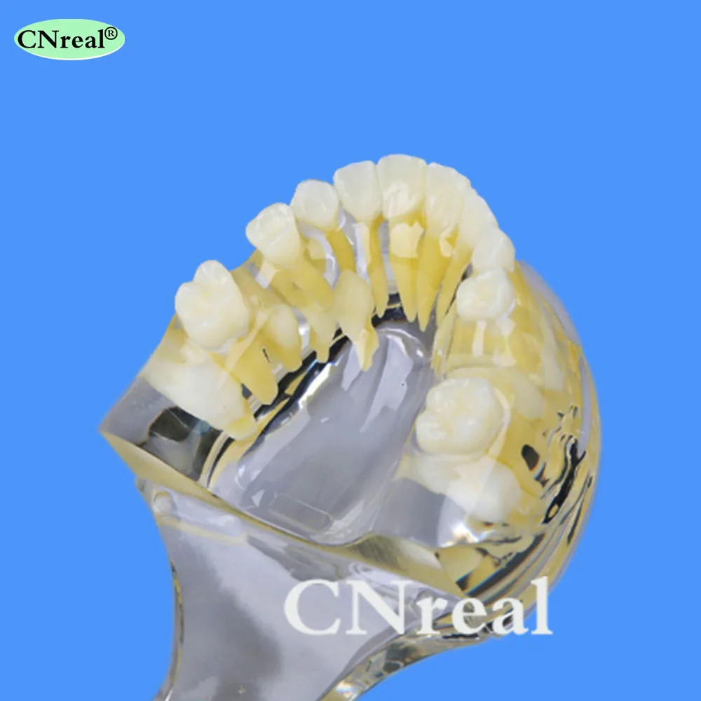 1 шт. зубные Лиственные/постоянные зубы чередование модель с фиксатором для обучения стоматологии