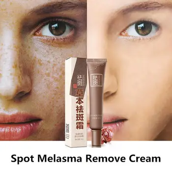 

BellyLady Woman Dark Spot Corrector Skin Whitening Fade Face Cream Lightening Removal Serum Reduces Age Spots Freckles Melasma