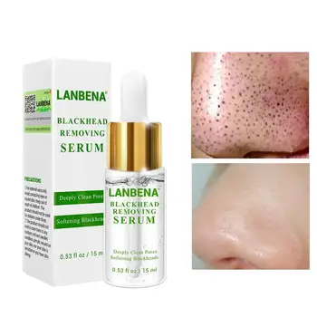 

1pc Blackhead Derived Liquid 15ml Whitehead Acne Female Deep Cleansing Shrink Pores Gel Bleaching Whitening Moisturizing Face