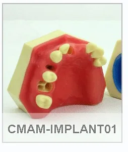 CMAM/12572 зубные-стандартный челюсти, человеческого устные зубоврачебная преподавания анатомическая модель