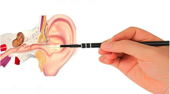 Otoscope endoscope HD 1.3 million diameter 5.5mm pick ear track endoscope visible ear Otoscope endoscope HD 1.3 million diameter 5.5mm pick ear track endoscope visible ear