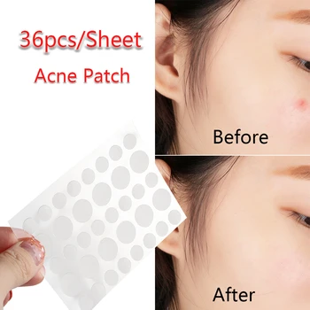 

36Pcs/Sheet Pimple Treatment Sticker Hydrocolloid Acne Patch Set Skin Tag Acne Patch Acne and Skin Tag Remover Patches