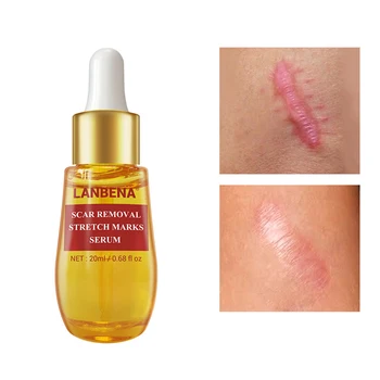 

20ml Acne Scar Remove Serum Treatment for Acne Remove Marks Anti Acne hyaluronic acid Acne Scar Remove Hot Sale