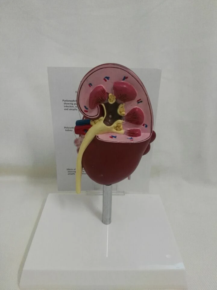 1 шт. анатомическая модель 2-сторонняя больных анатомии Medica l клубочках почек нефрона r еналь анатомическая модель