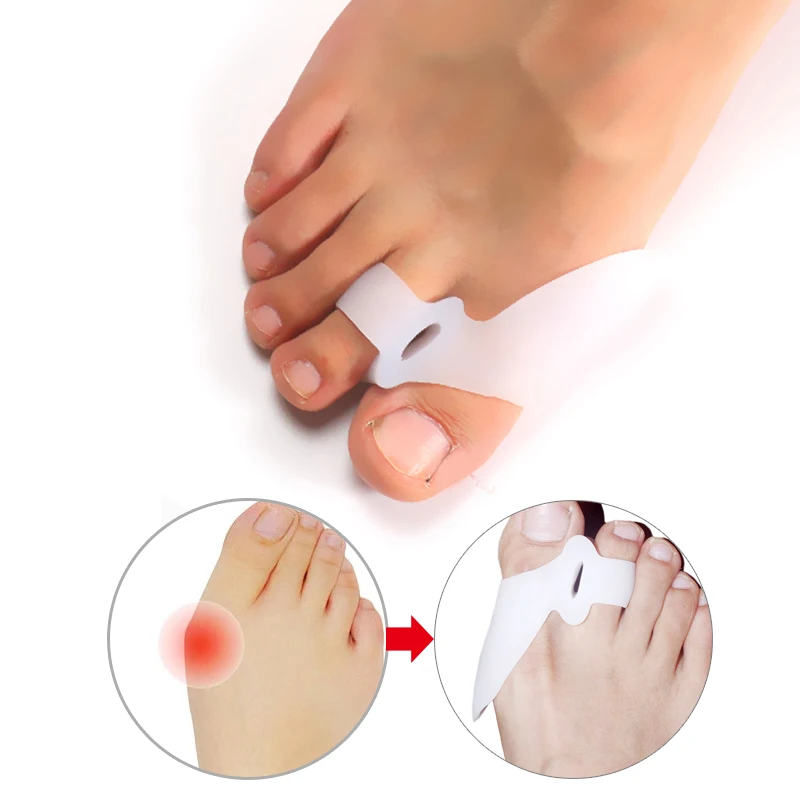 1 пара Hallux Valgus Bicyclic Thumb ортопедические подтяжки для коррекции ортопедических ежедневных силиконовых ног большой кости Ноги Уход Педикюр