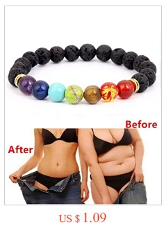 HTB1OdKOXOzxK1Rjy1zkq6yHrVXaV