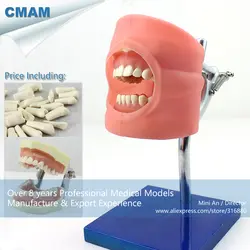 12557/CMAM-DENTAL01 подготовки стоматологический Учебная модель для стоматологов манекена, медицинские товары учебных анатомические модели