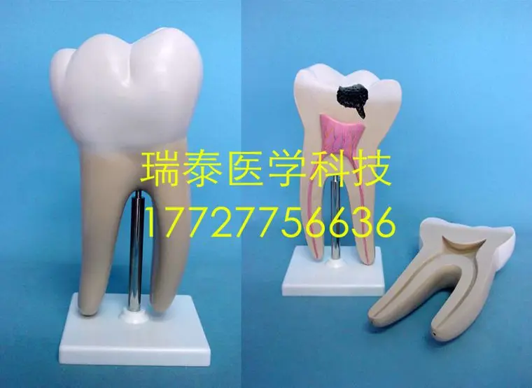 24*24*30 см медицинская научная новая зубная модель, модели для распада зубов, стоматологическая анатомия, 2 части, ПВХ