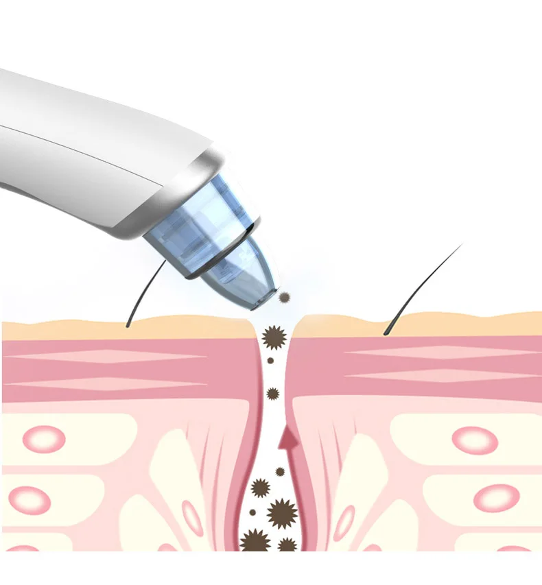 Blackhead Remover Skin Care Face acne Clean