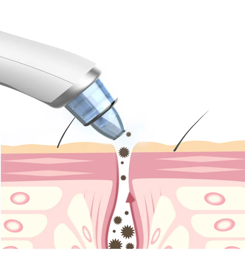 Bettyliss вакуумная Акне на лице черная головка машинка для удаления кожи пылесос черная голова очиститель пор