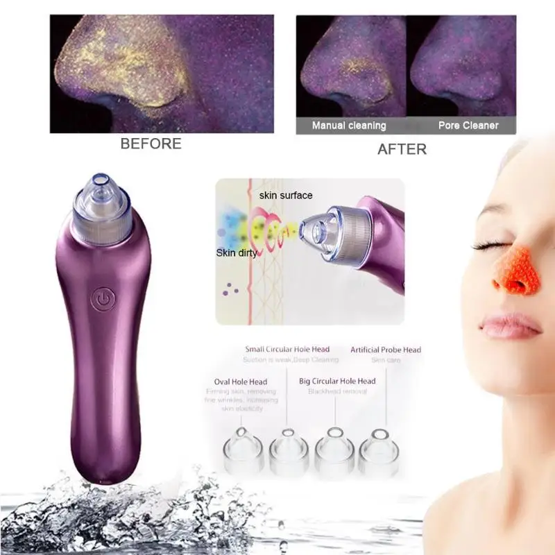 Online Pori Kekosongan Hitam Titik Alat Penghilang Bincul Hitam Acne Titik Noir Pori Pembersih Wajah Perawatan Kulit Wajah Beauty Poin Mesin Noirs