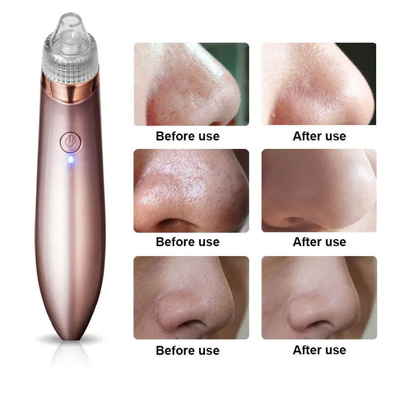 

1 Set Blackhead Remover Skin Care Pore Vacuum Acne Pimple Removal Suction Tool Facial Dermabrasion Face Clean Beauty Machine