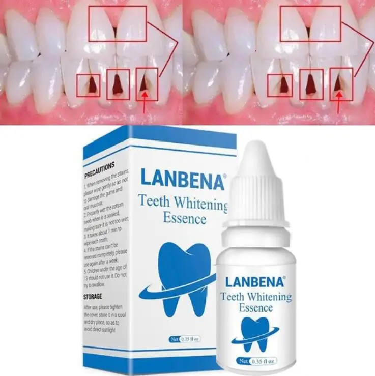 Сыворотка для отбеливания зубов LANBENA порошок гигиены полости рта гель очистки