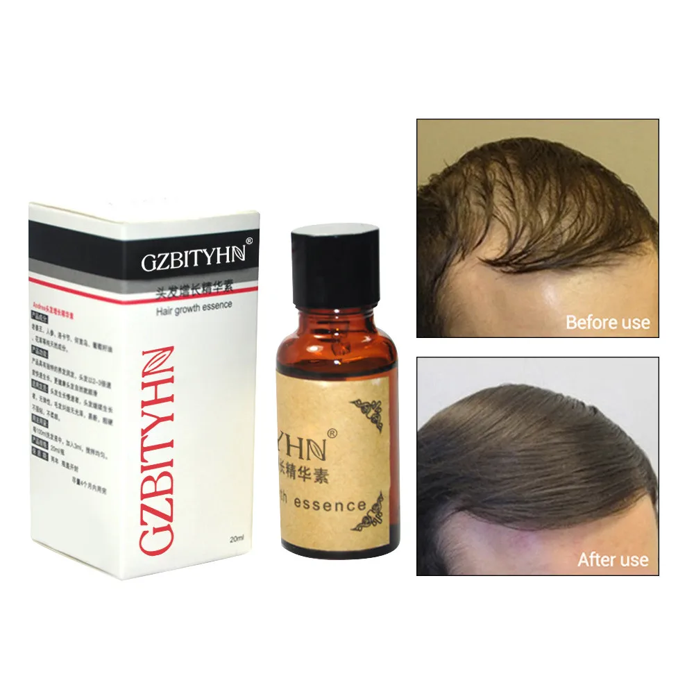 Most Effective Asia's No.1 Hair Growth Serum Oil Natural Extract Hair Serum шампунь Shampoo шампунь для волос