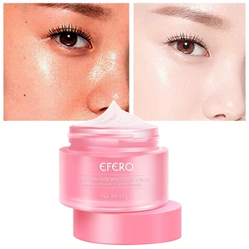 

30g Remove Freckles Cream Skin Whitening Cream Reduces Age Spots Fade Dark Spots Treatment Stain Face Cream Skin Care