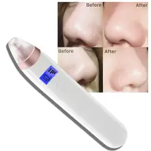 New Vacuum Pore Cleaner Blackheads Electric Acne Clean Exfoliating Cleansing Face Facial Instrument Comedones Battery Plate linlin vacuum pore cleaner blackheads electric acne clean exfoliating cleansing face facial instrument comedones battery plate