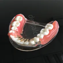Зубная мандибль имплантат сверхпротез модель зубов с сосудов Demo 6006 модель зубов