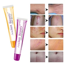 Крем для лица отбеливающий крем для кожи против акне маска для лица средство против акне, шрамов пор Bioaqua Acne CreamTSLM1