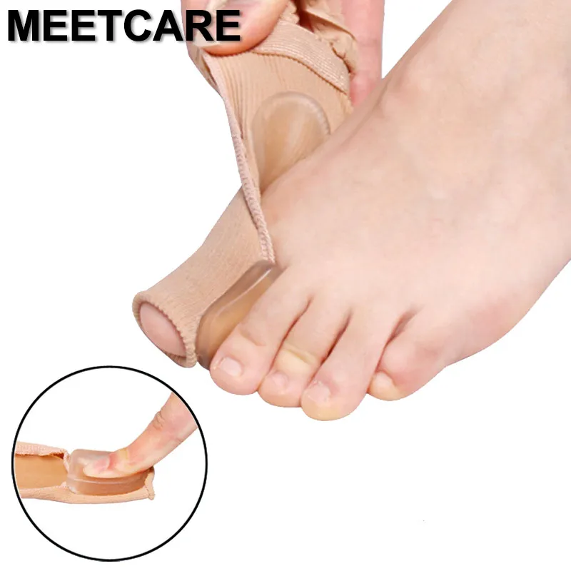 

Japan Style Lace Toes Protective Case Enhanced Stretch Hallux Valgus Correction Tape Foot Care Bunion Orthopedic Thumb Braces