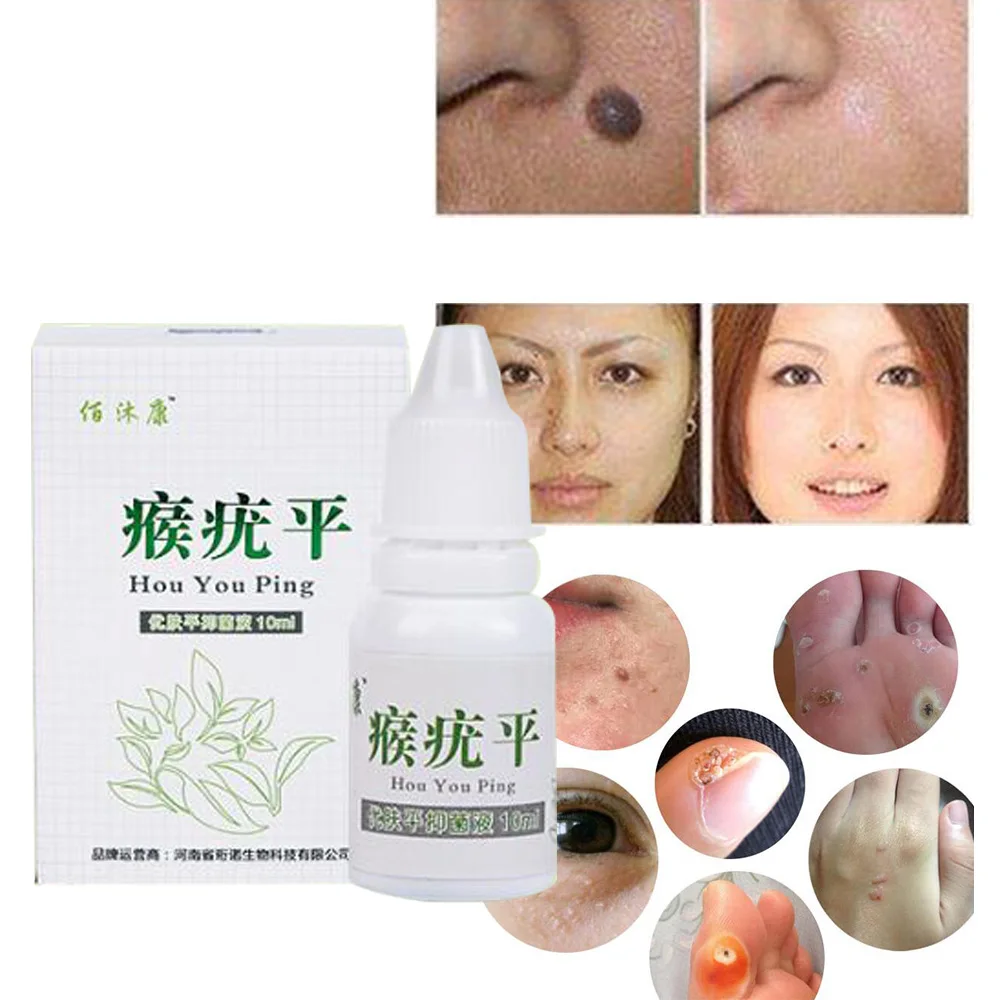 10ml Mole & Skin Tag Repair Solution Painless Dark Spot Face Wart Freckle Cream Oil D144 | Красота и здоровье