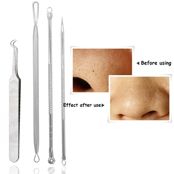 

4Pcs/Set Whitehead Cleaner Needles Tool Blackhead Tweezers Blemish Acne Pimple Extractor Face Cleaning Black Spots Removal Kits