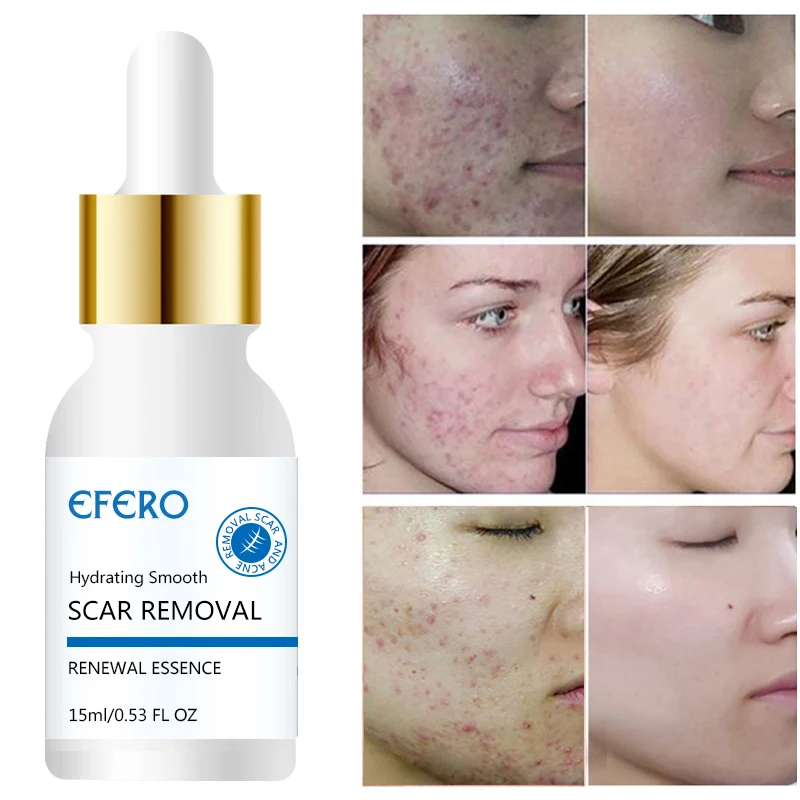 

2 Bottle Moisturizing Face Serum Shrink Pores Anti Aging Serum Acne Treatment Moisturizer Essence Face Whitening Cream Skin Care