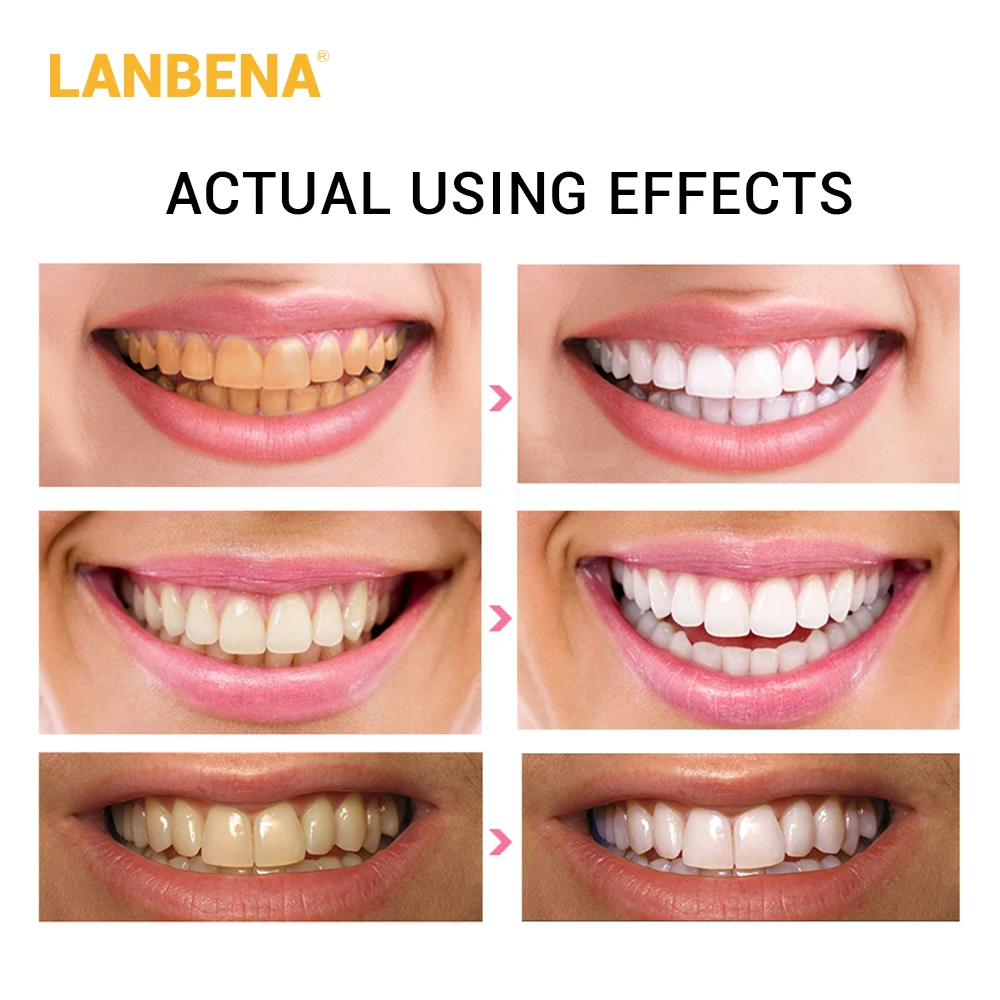 LANBENA отбеливающие полоски для зубов ежедневное использование+ ночная гигиена полости рта виниры для зубов белые полоски удаляют пятна от налета уход за полостью рта 12 пар