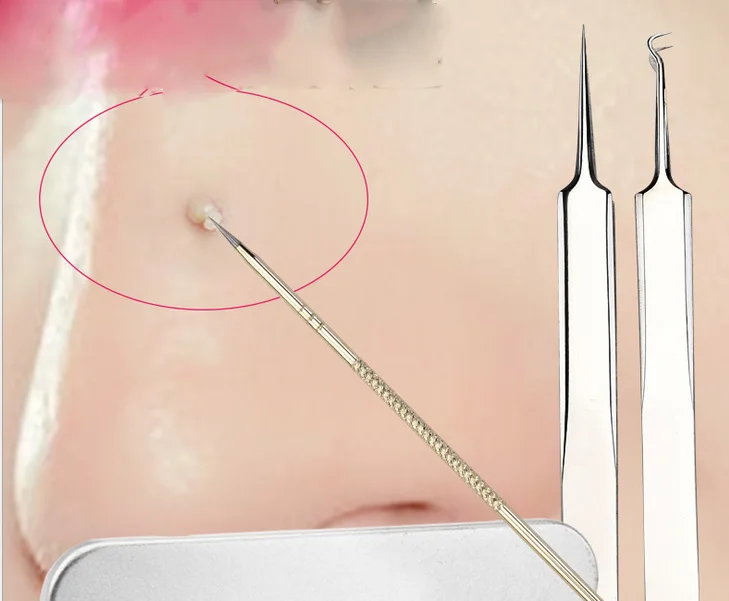 Ferramenta de Limpeza Beleza da Pele Sets Atacado - Set Removedores Blackhead Blemish Pimple Extractor Removedor Agulhas Facial Cuidados 100 4 Pçs 6 Utensílios de cuidado facial
