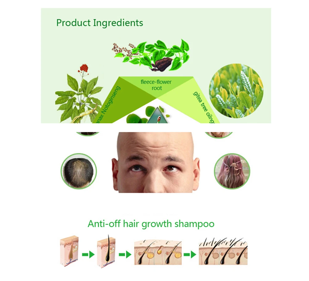 Шампунь против выпадения волос Китайский травяной Лечение роста волос профессиональное Предотвращение волос густые волосы уход продукт для взрослых 200 мл