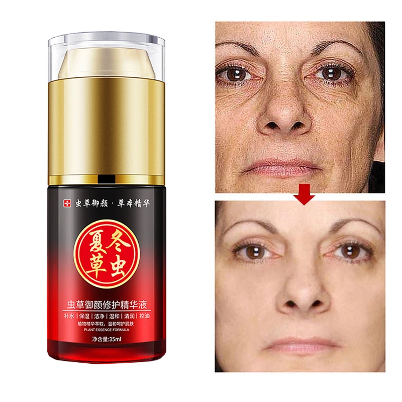 

Anti-Wrinkle Serum Facial 35ML Oil Control Face Skin Care Lotion Cordyceps Repair Essence Moisturizing Anti Aging Vitaminis P