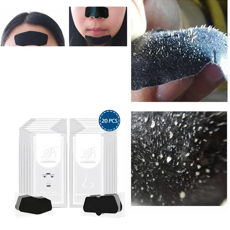 LANBENA Blackhead Remover Acne Treatment Nose Mask+Chin Forehead Black