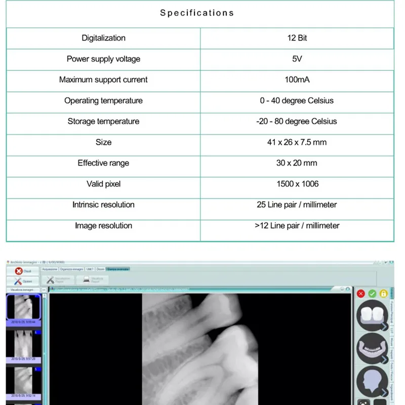 FSVIMEL новая стоматологическая рентгеновская система изображения цифровой датчик Rundeer