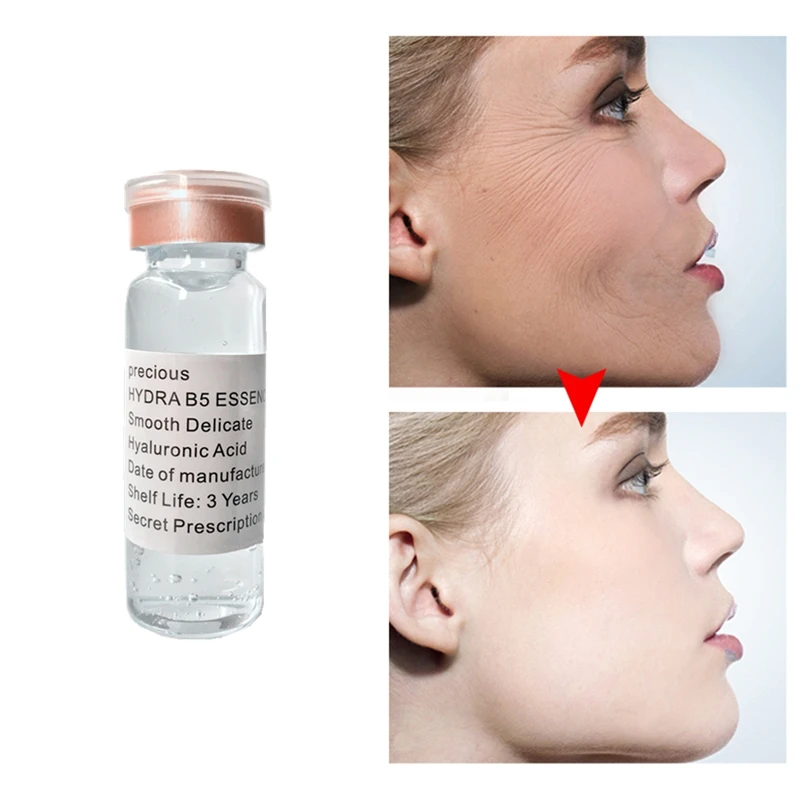 Acne Removing Serum Elastic Collagen Anti Scar Remover Skin Hyaluronic Acid Aging Cells Regeneration Delay Ageing Essence huismerk kopen in de aanbieding Acne Removing Serum Elastic Collagen Anti Scar Remover Skin Hyaluronic Acid Aging Cells Regeneration Delay Ageing Essence huismerk kopen in de aanbieding