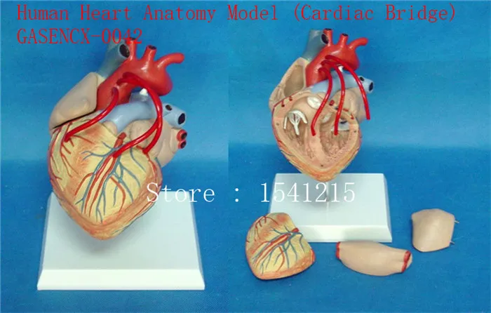 

Cardiac bypass surgery model Teaching medicine Body specimen model Human Heart Anatomy Model Cardiac Bridge - GASENCX-0042