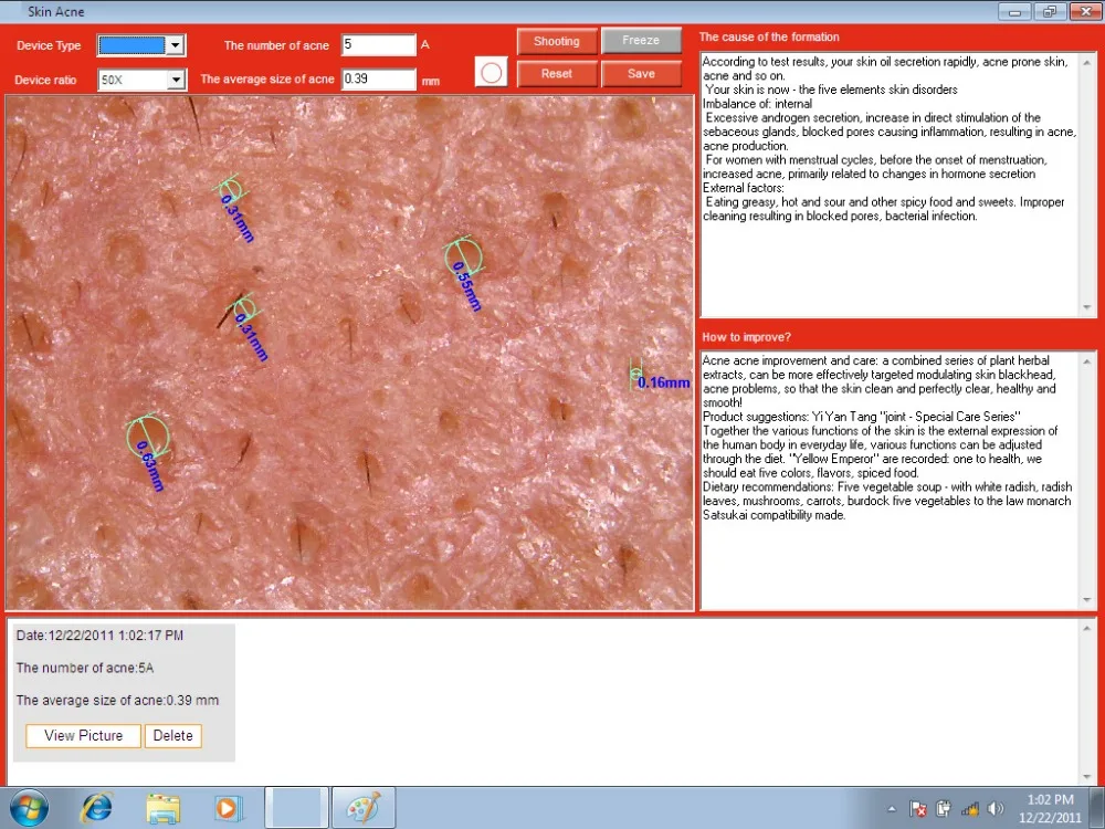 3D Skin scope8 (2)