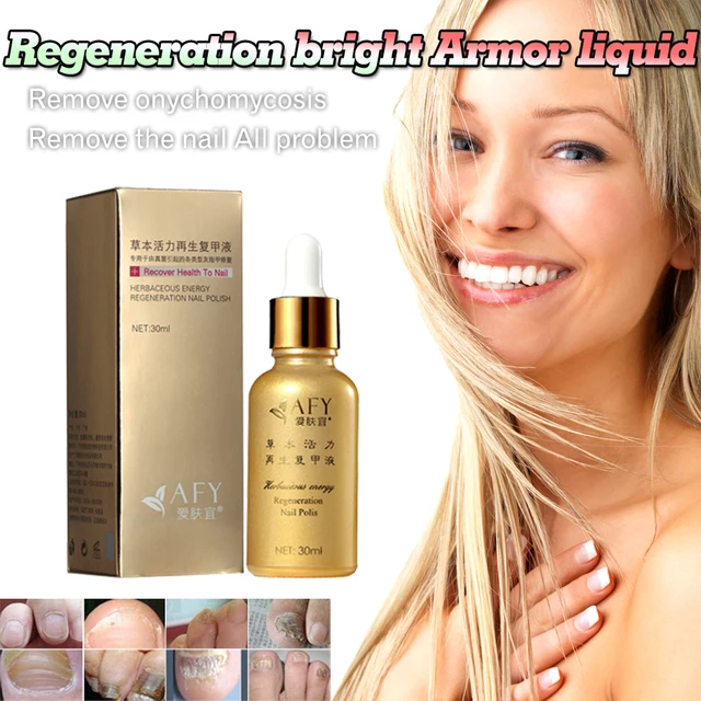free shipping fungal recover health to nail onychomycosis treatment